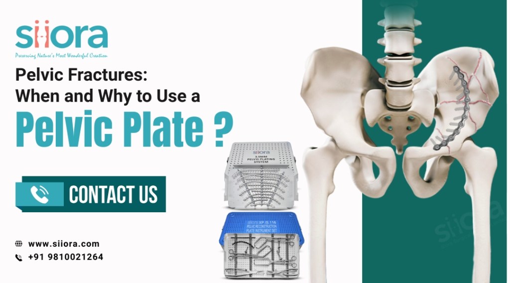 Pelvic Plate